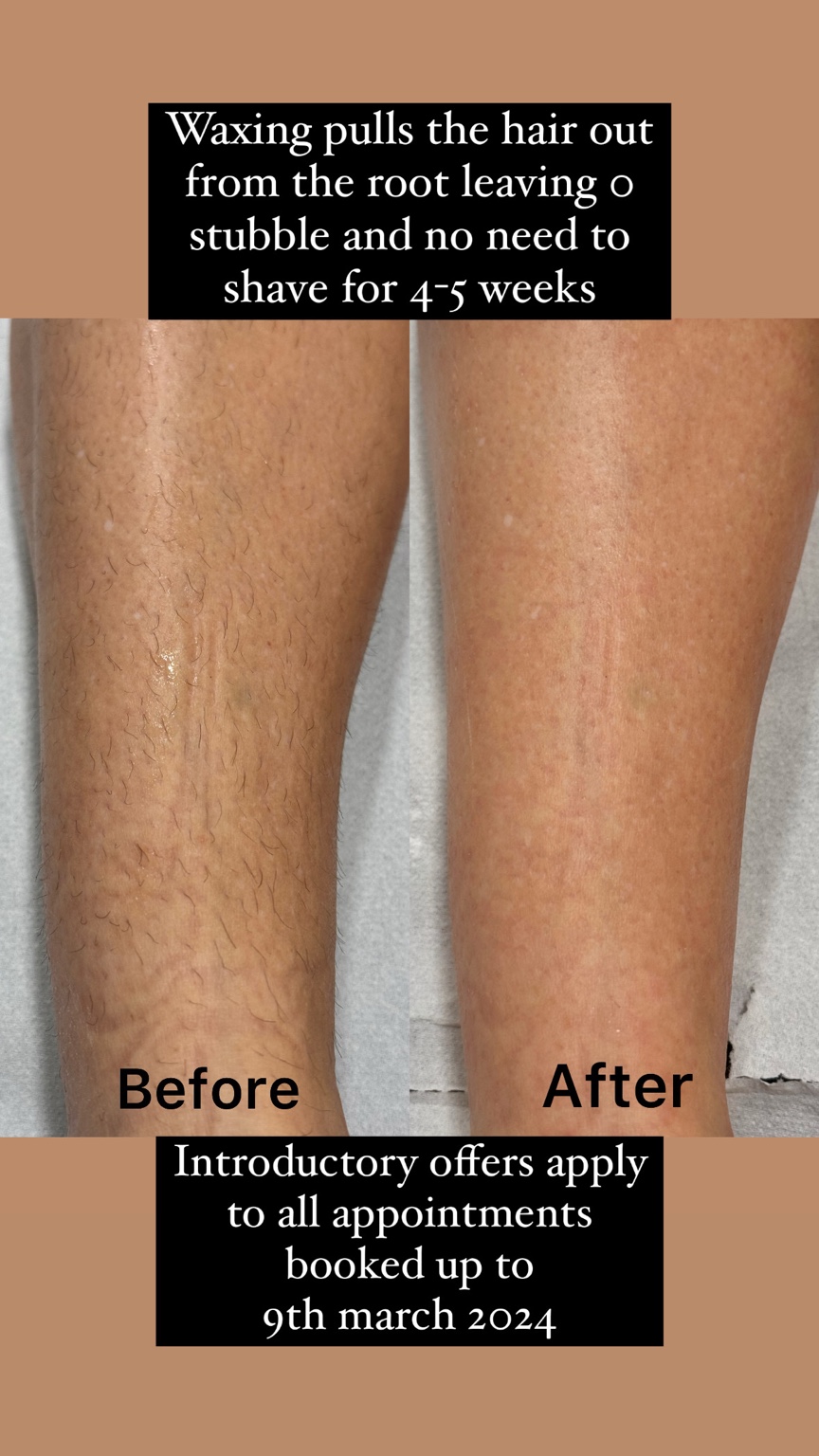 Alrose beauty treatment result