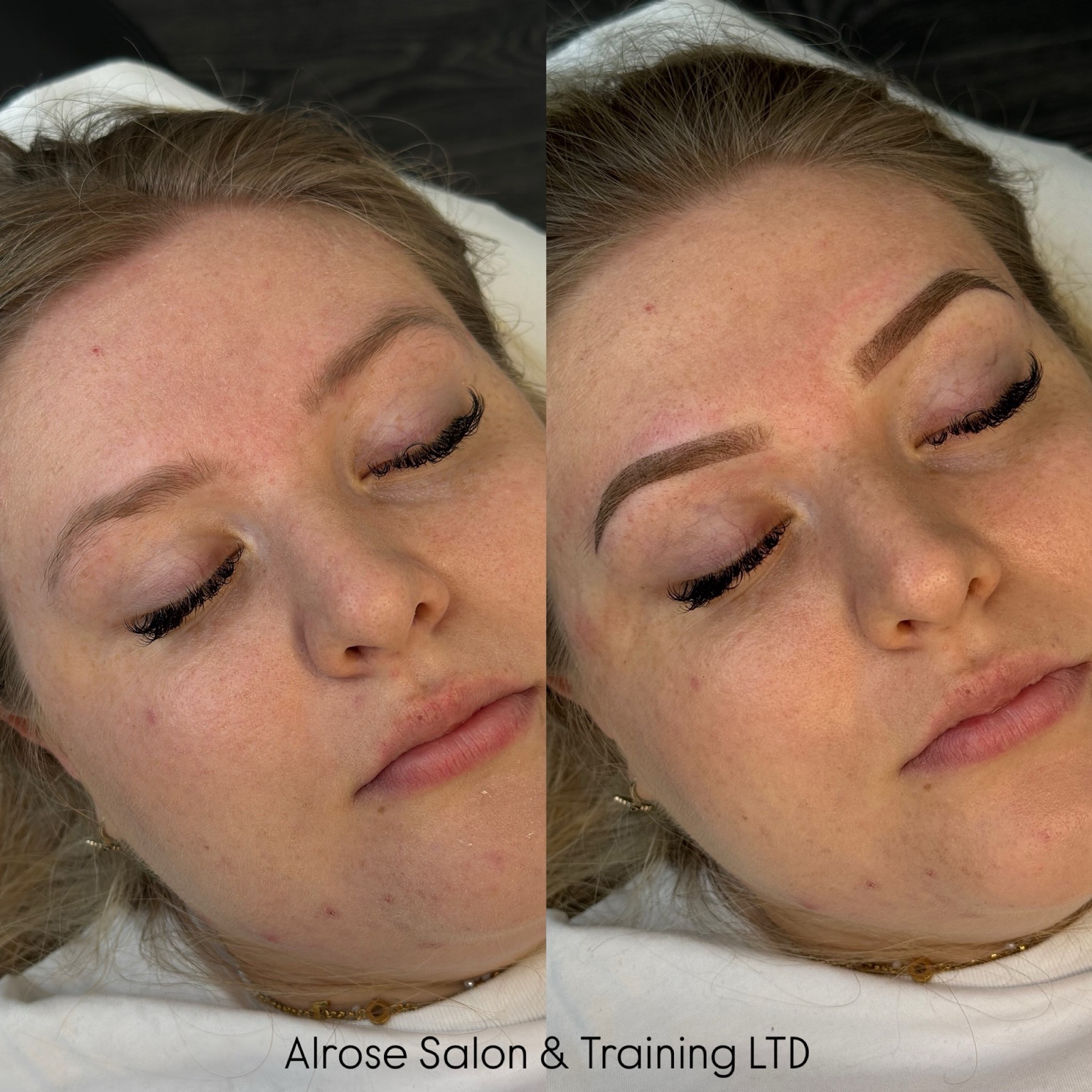 Alrose beauty treatment result