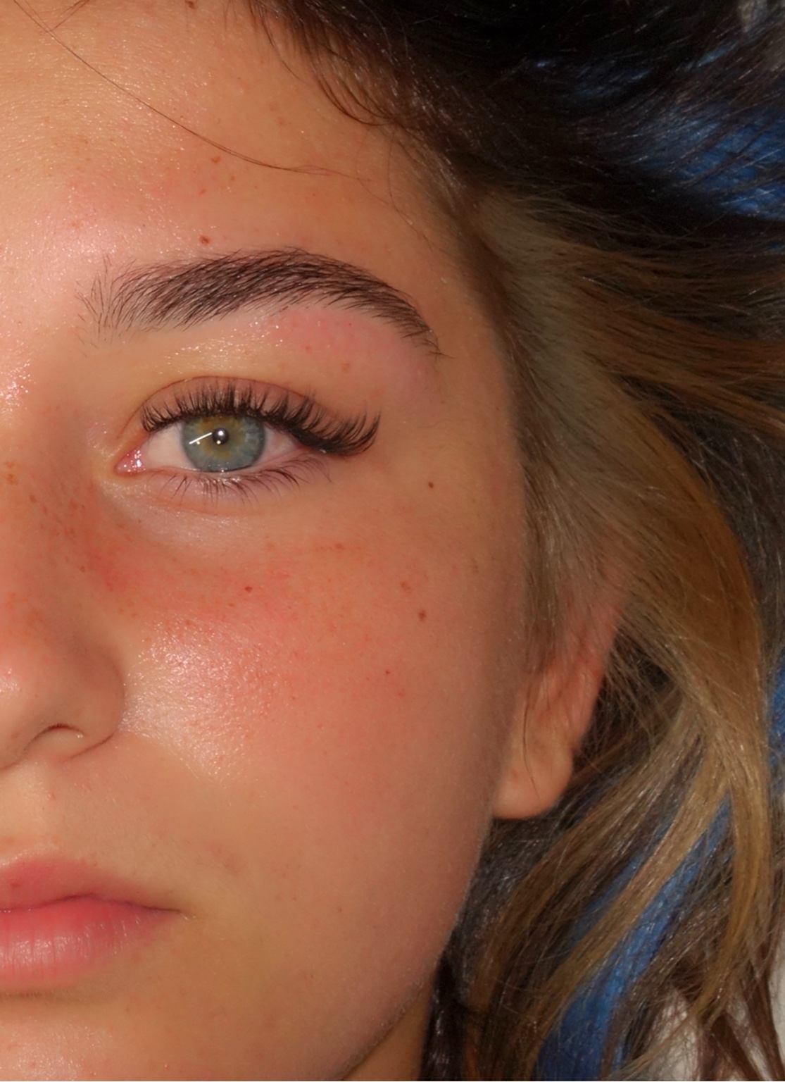 Alrose beauty treatment result