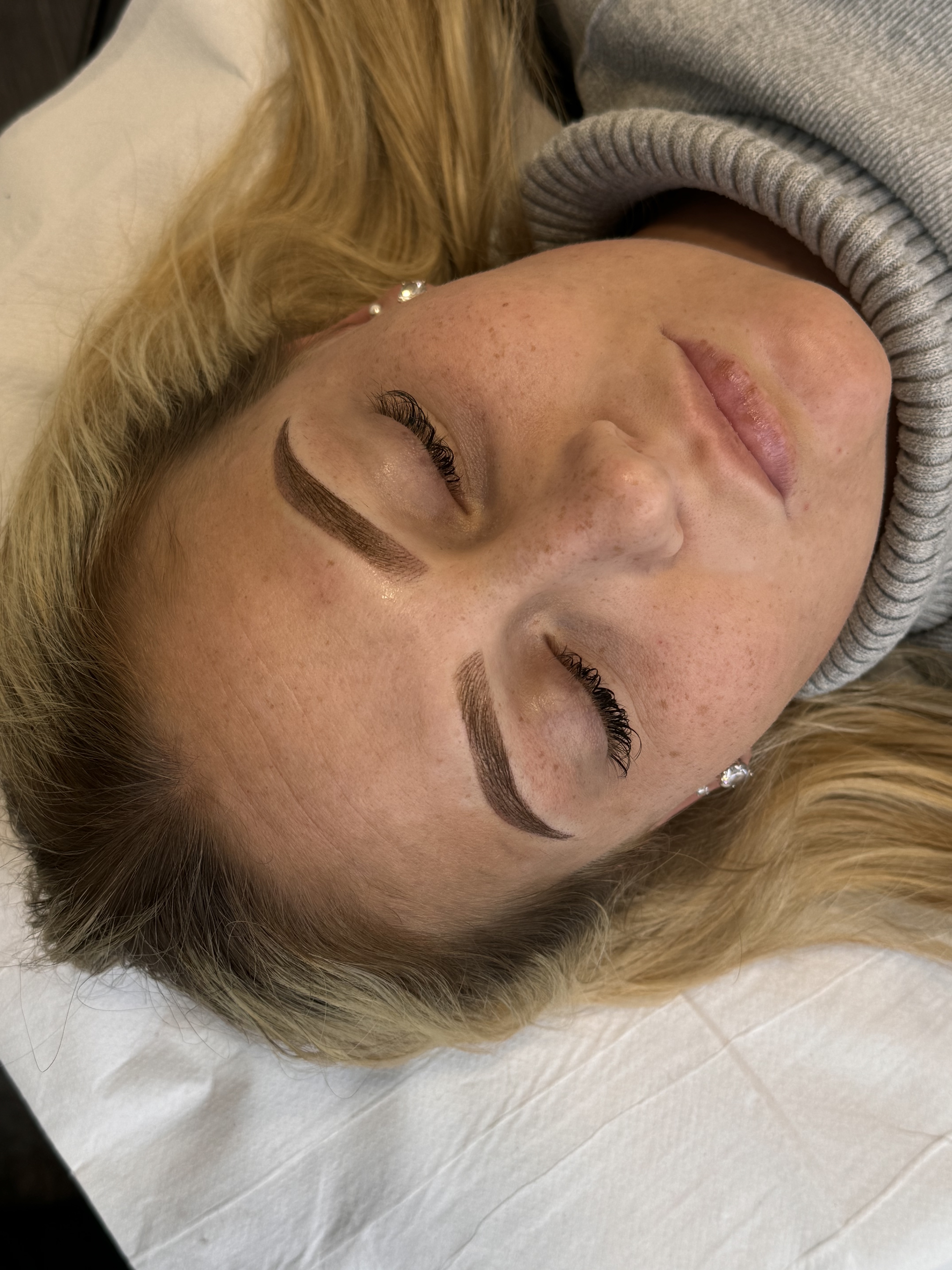 Alrose beauty treatment result