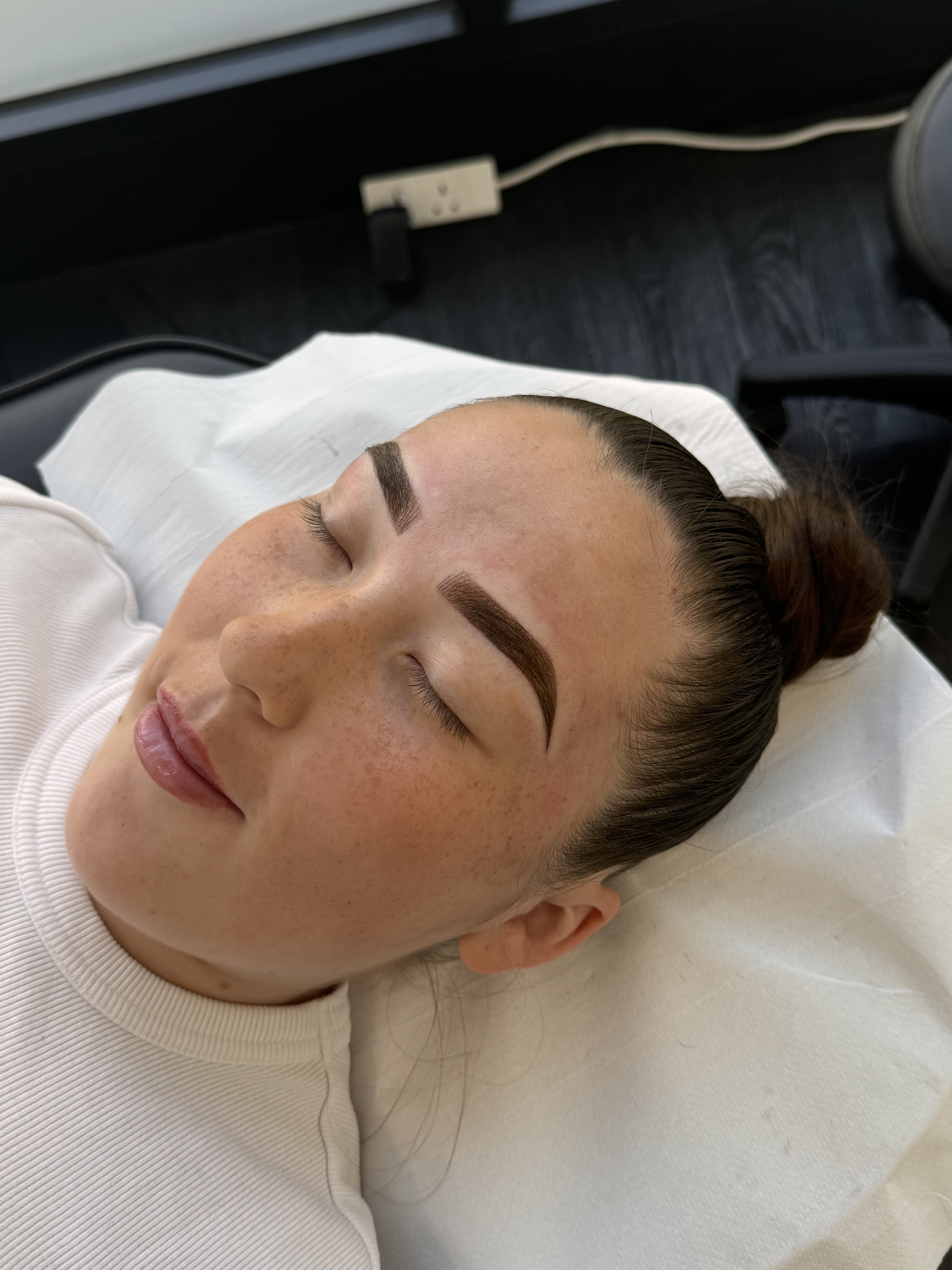 Alrose beauty treatment result