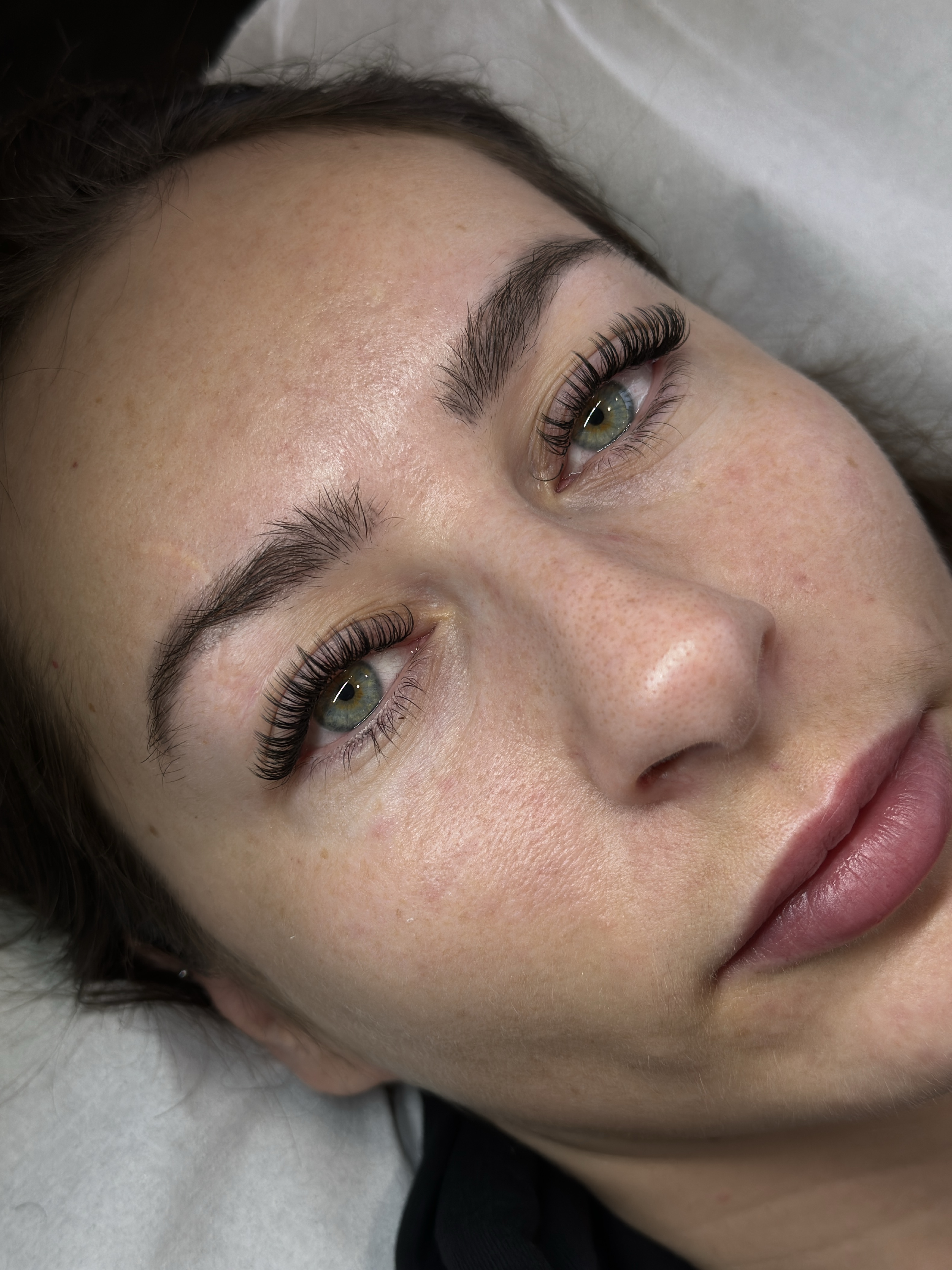 Alrose beauty treatment result