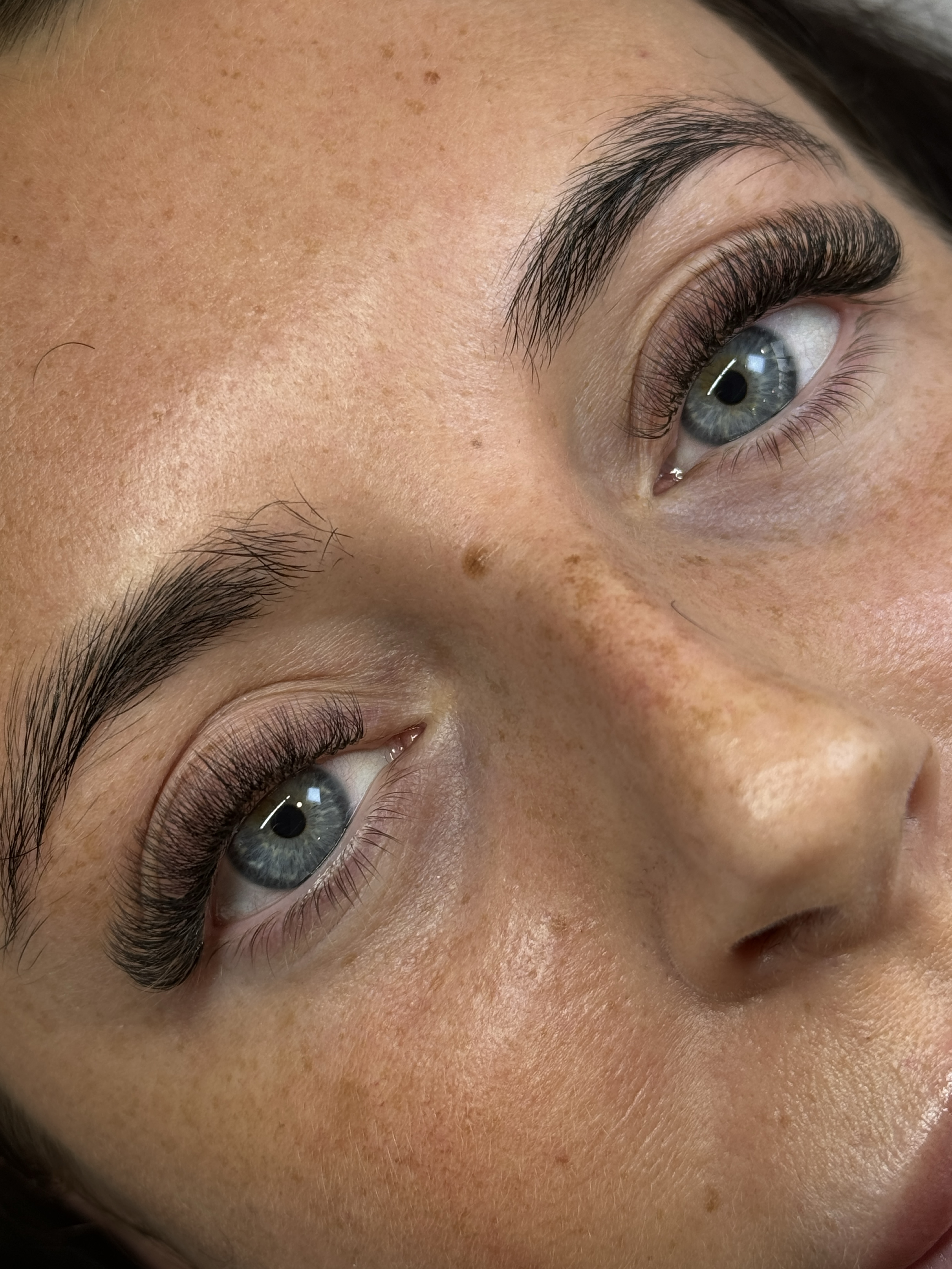 Alrose beauty treatment result