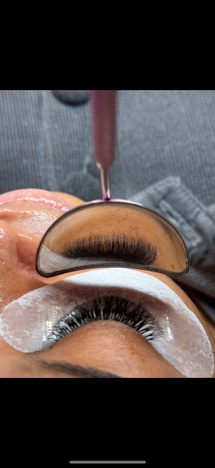 Alrose beauty treatment result